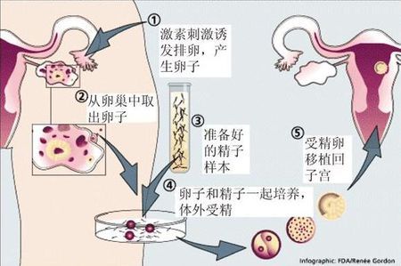 关于冰原生殖